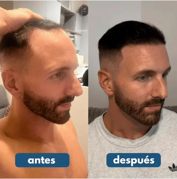 Rensola - Hair Growth Serum